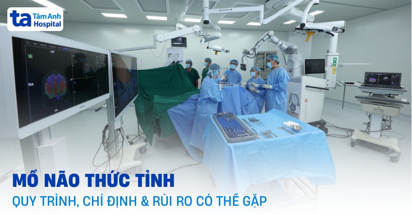Mổ não thức tỉnh là gì? Quy trình, chỉ định và rủi ro có thể gặp