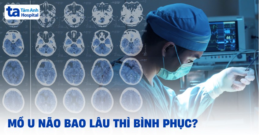 Mổ u não bao lâu thì bình phục? Yếu tố ảnh hưởng thời gian hồi phục