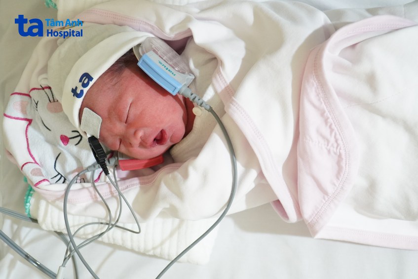 Một em bé sinh non được kiểm tra thính học tại khoa Sơ sinh