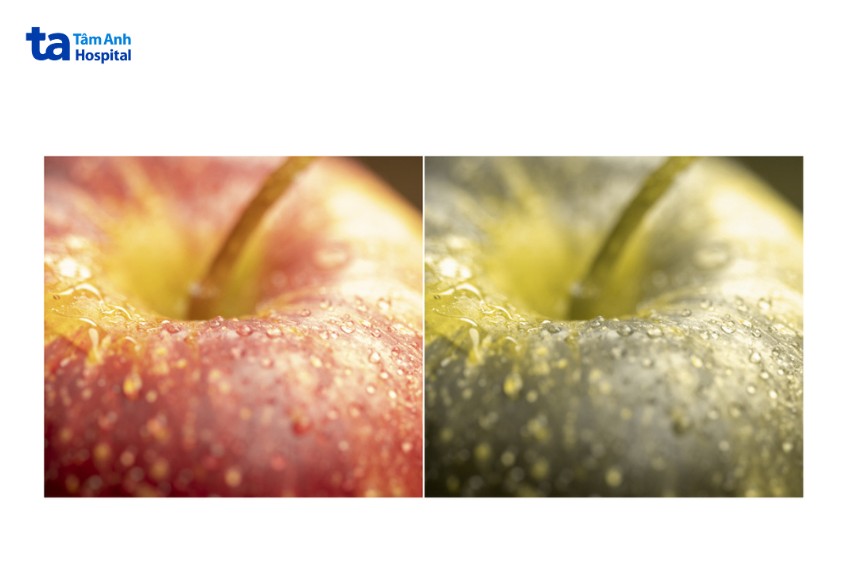 mù màu khiến sai lệch màu