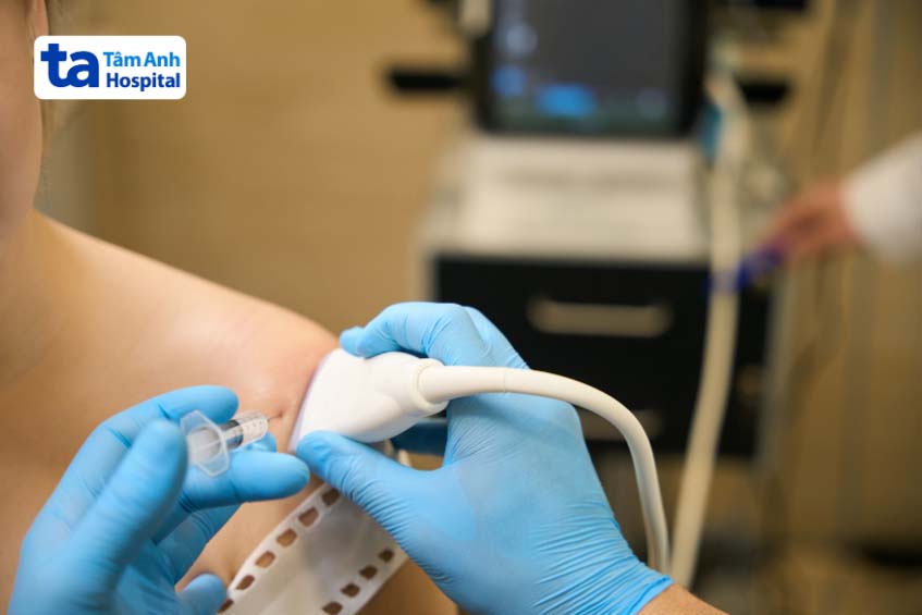 mục đích hút dịch khớp