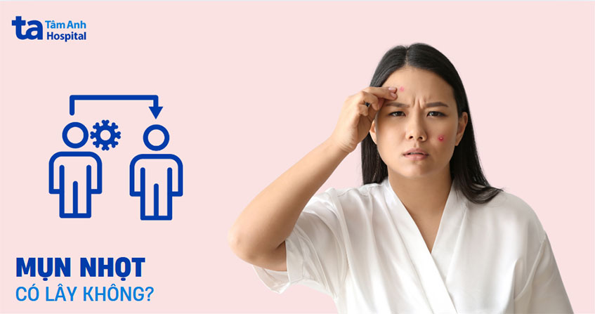 Mụn nhọt có lây không? Phòng ngừa và điều trị như thế nào?