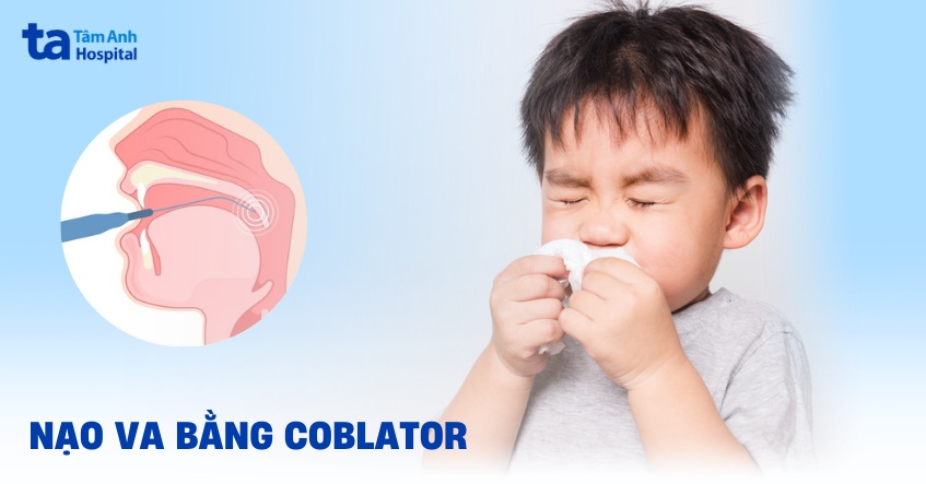 Phẫu thuật nội soi nạo va bằng coblator: Quy trình và chi phí
