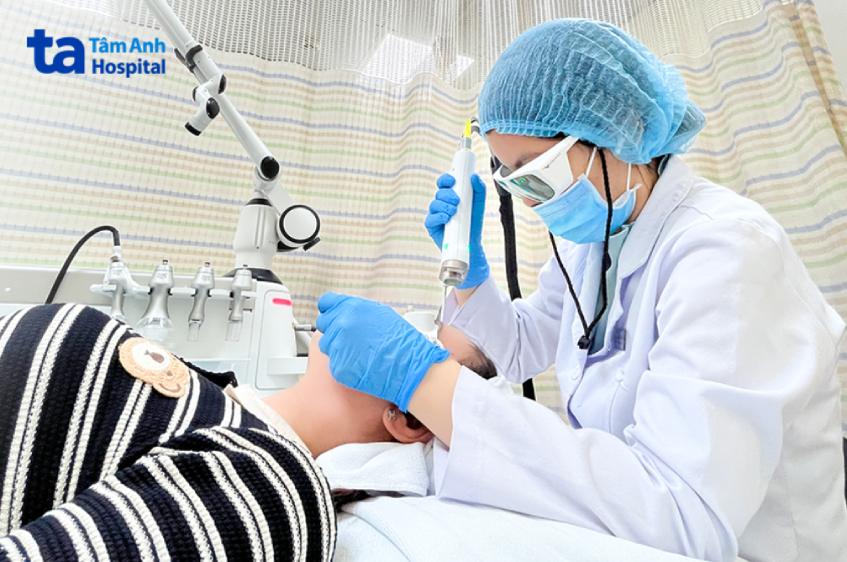 người bệnh đang được bắn laser 4d