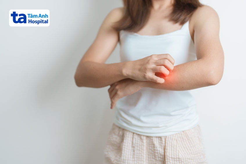 nguy cơ mắc các bệnh đồng mắc