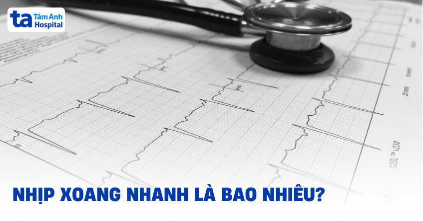 Nhịp xoang nhanh là bao nhiêu?