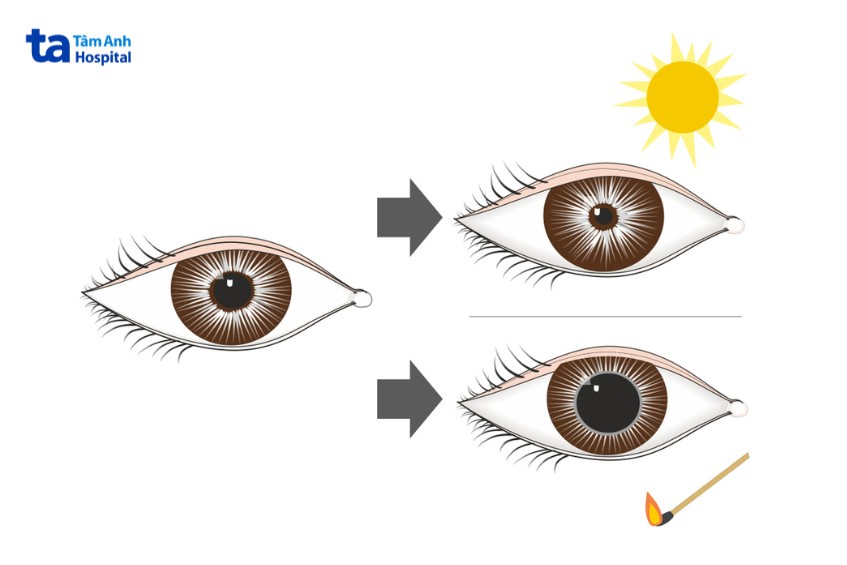 phản xạ đồng tử theo môi trường