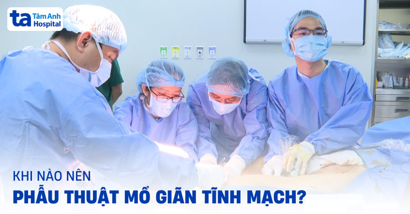 Phẫu thuật giãn tĩnh mạch: Vai trò, chỉ định, quy trình [A-Z]