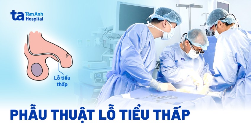 Phẫu thuật lỗ tiểu thấp