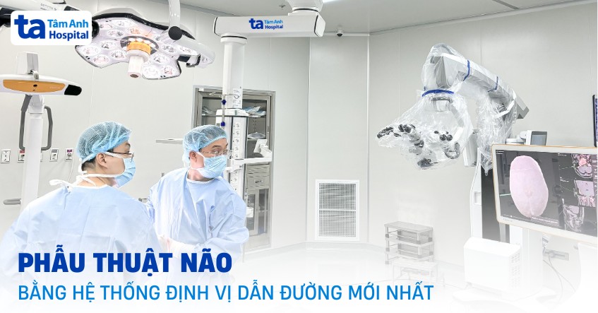 Phẫu thuật não bằng hệ thống định vị dẫn đường Navigation hiện đại