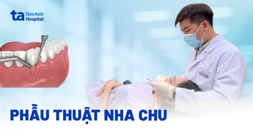 Phẫu thuật nha chu: Quy trình, chi phí và những điều cần biết