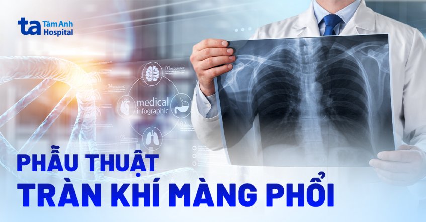 Phẫu thuật tràn khí màng phổi