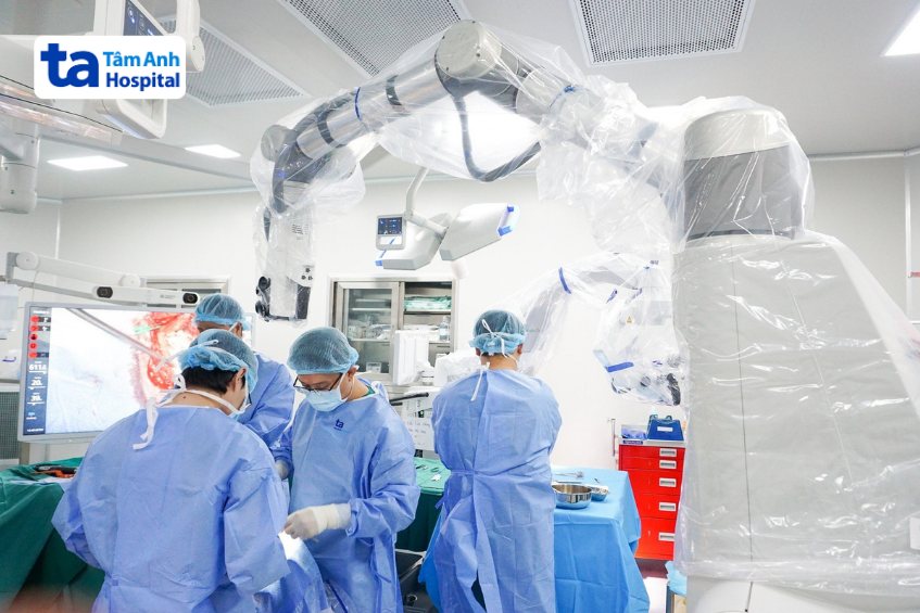 quá trình phẫu thuật não bằng robot tại tâm anh