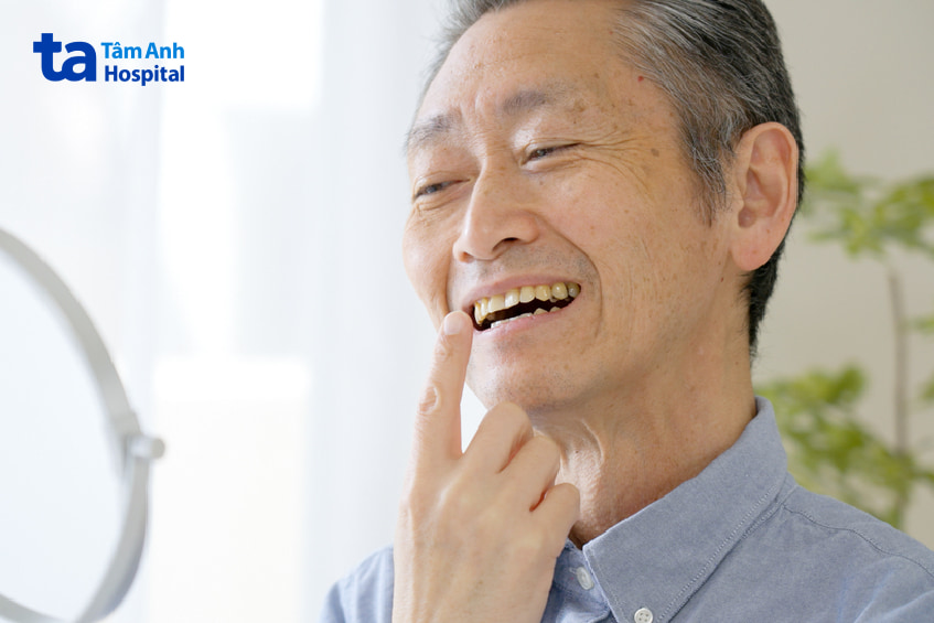 Nguyên nhân răng bị xỉn màu