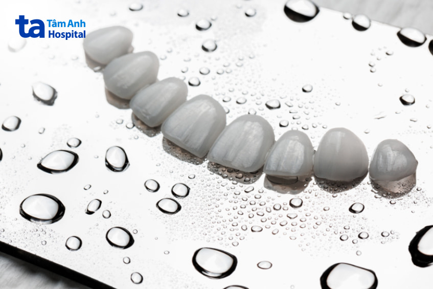 Dán sứ veneer khắc phục răng bị nhiễm màu