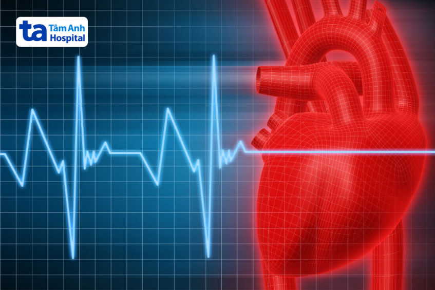 Rối loạn nhịp tim là một trong những nguyên nhân gây ngưng tim khi ngủ