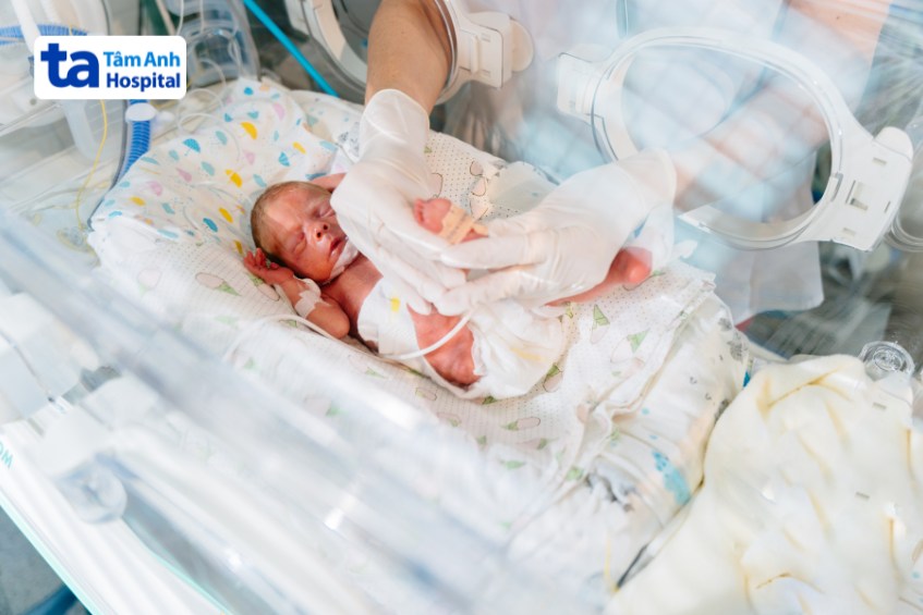 Sau khi bơm Surfactant trẻ sơ sinh sẽ được chăm sóc