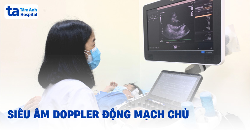 Siêu âm Doppler động mạch chủ: Ưu điểm, chỉ định và quy trình