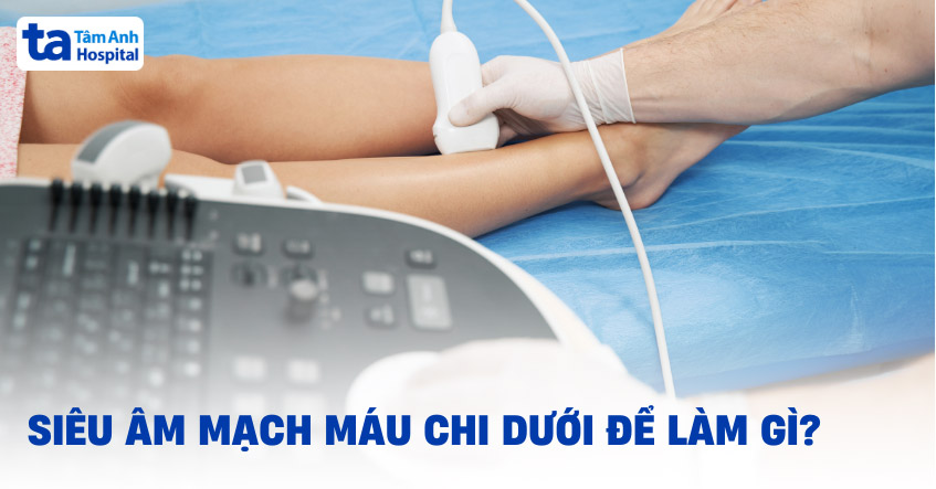Siêu âm mạch máu chi dưới là gì? Chỉ định, quy trình và chi phí