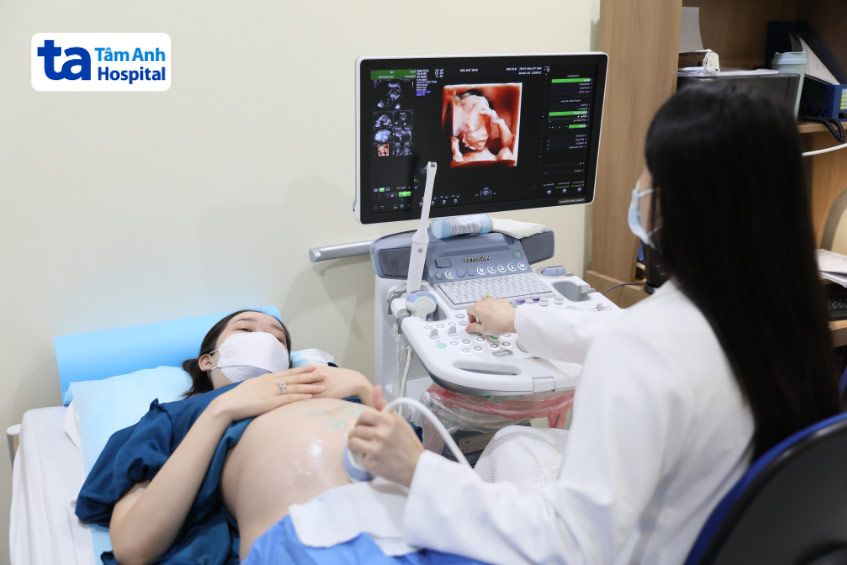 Siêu âm thai giúp chẩn đoán và phát hiện những dấu hiệu bất thường