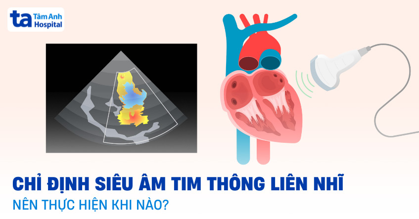 3 cách siêu âm tim thông liên nhĩ: Chỉ định, vai trò và quy trình