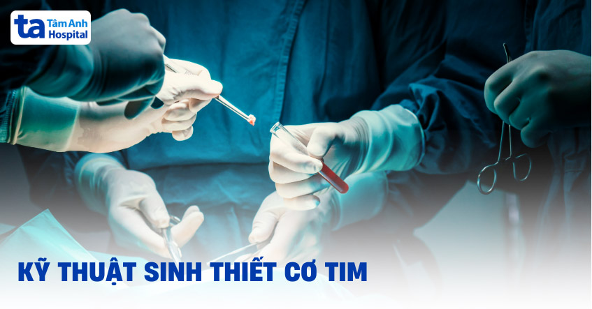 Kỹ thuật sinh thiết cơ tim: Mục đích, chỉ định và rủi ro