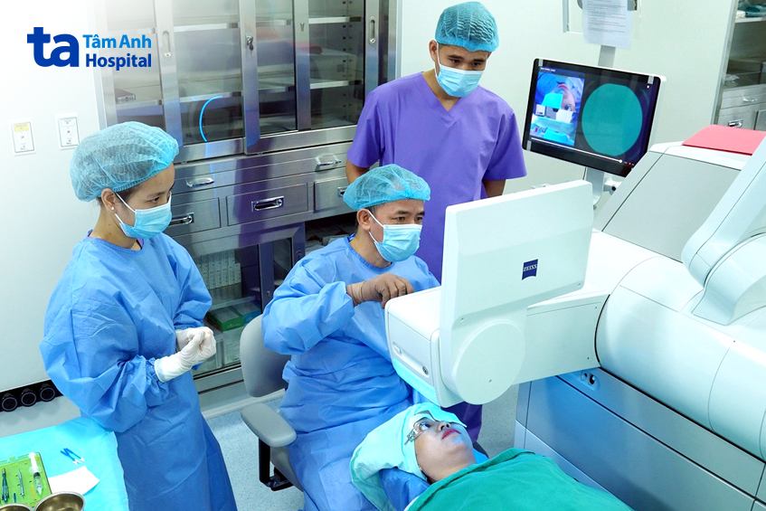 smile pro là phương pháp mổ hiện đại