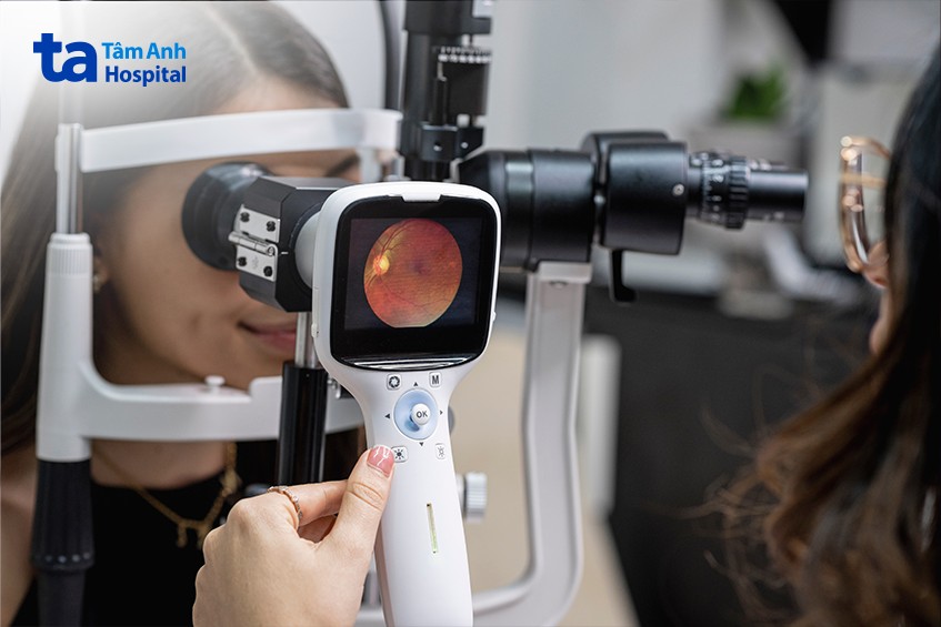 soi đáy mắt chẩn đoán phù gai thị