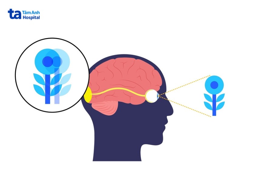 song thị khiến mắt nhìn thành hai