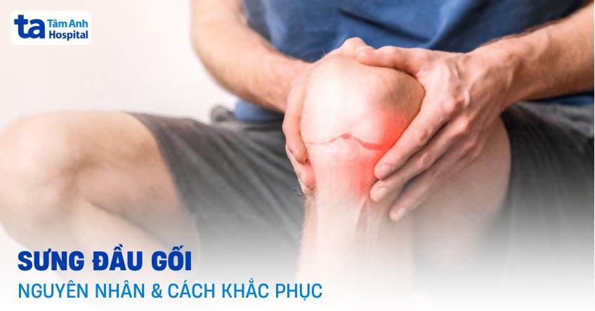 Sưng dầu gối