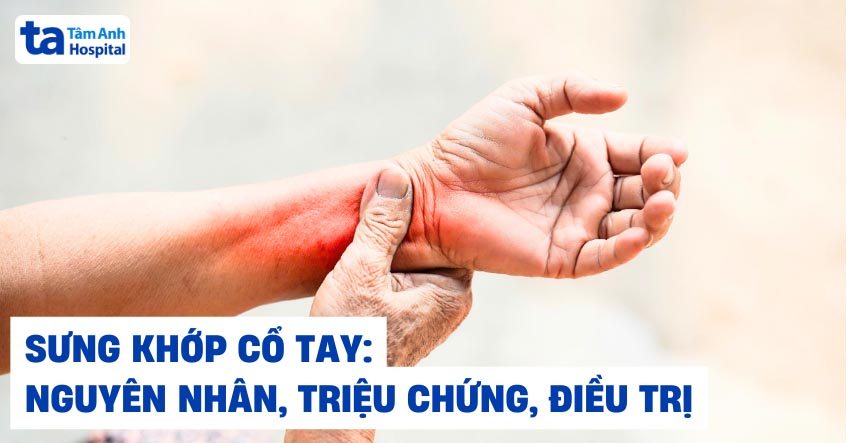 Sưng khớp cổ tay: Nguyên nhân triệu chứng và cách chữa trị