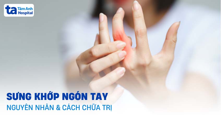 Sưng khớp ngón tay