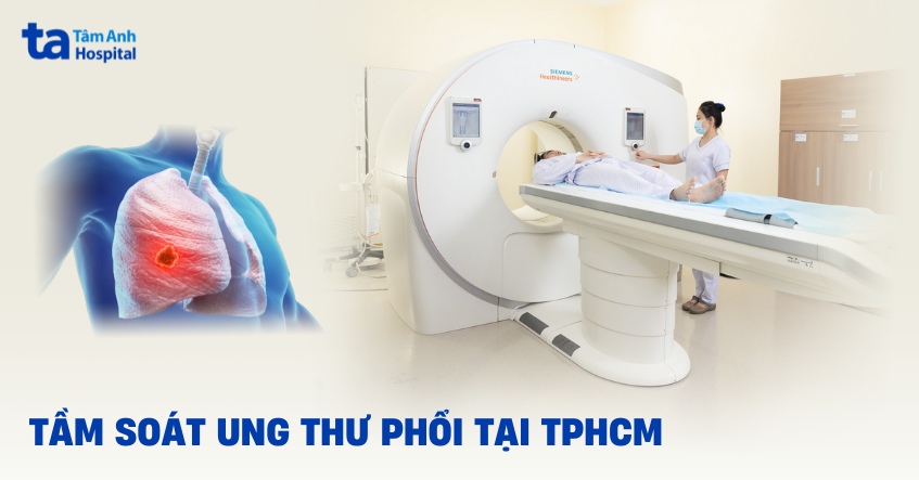 2 địa chỉ khám tầm soát ung thư phổi tại TPHCM tốt nhất hiện nay