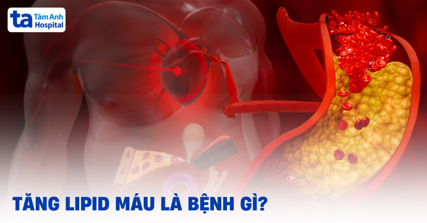 Tăng lipid máu là bệnh gì?