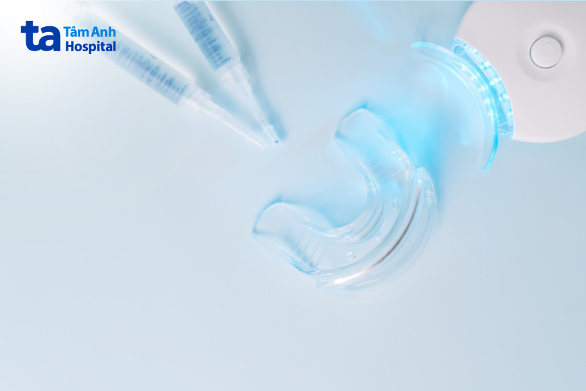 Sử dụng bộ kit làm trắng răng tại nhà