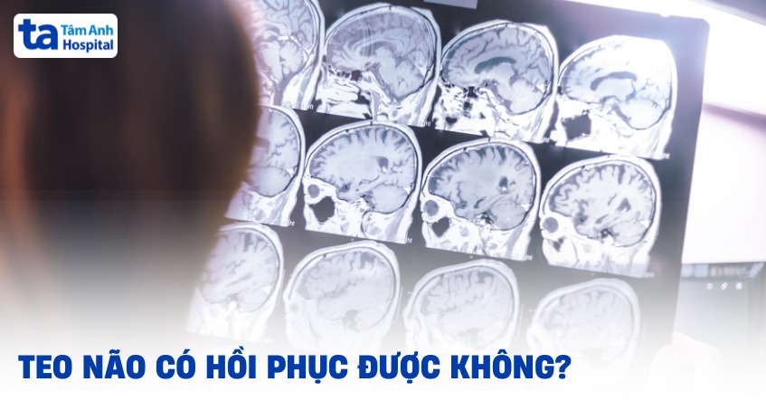 Teo não có hồi phục được không? Kiểm soát diễn tiến bệnh ra sao?