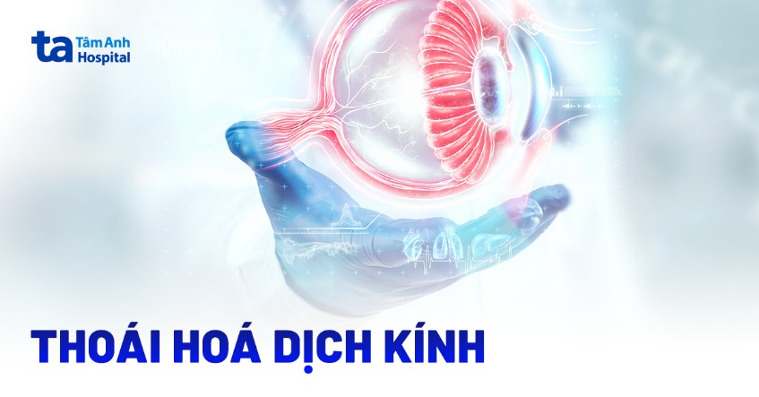 Thoái hóa dịch kính: Nguyên nhân, triệu chứng, chẩn đoán và điều trị