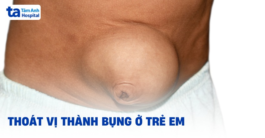 Thoát vị thành bụng ở trẻ em: Nguyên nhân, dấu hiệu và điều trị