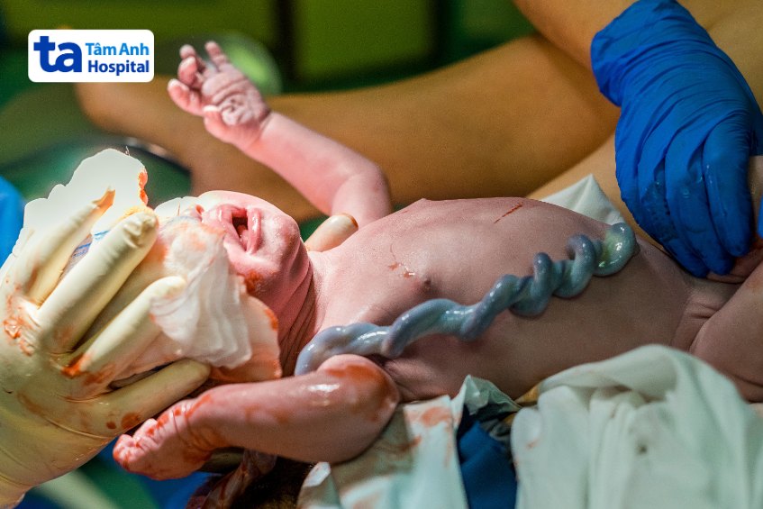 thu thập lưu trữ tế bào gốc cho trẻ sơ sinh