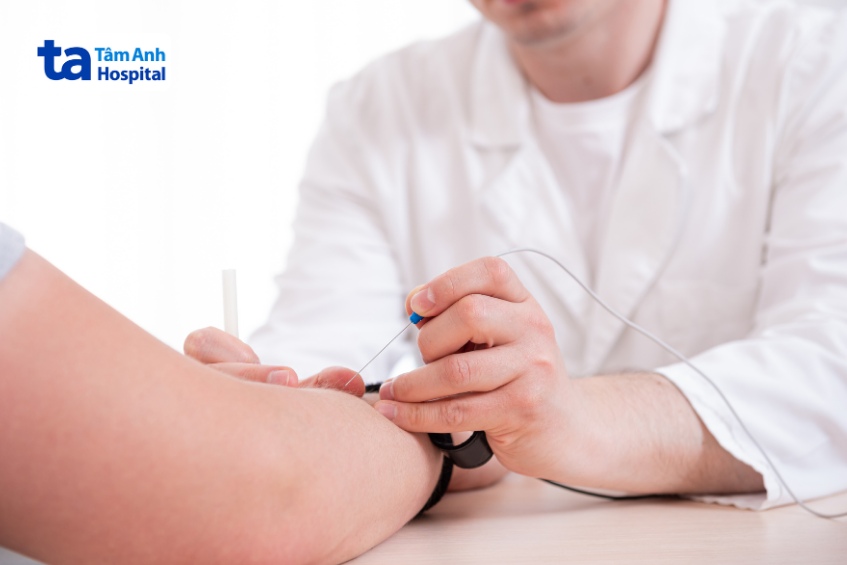 thực hiện đo điện cơ chẩn đoán bệnh nhược cơ