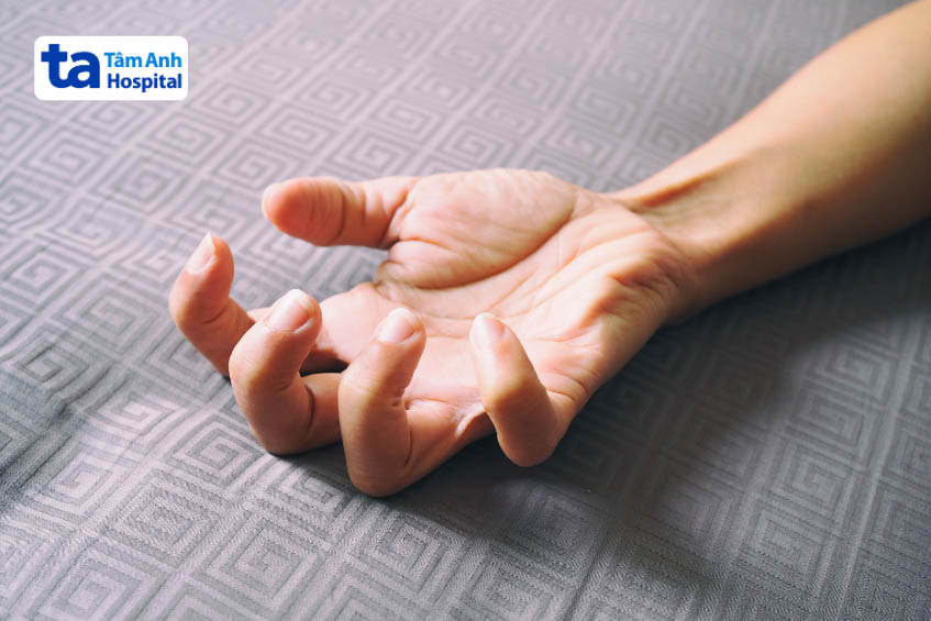 Thuốc động kinh Topmax 25mg