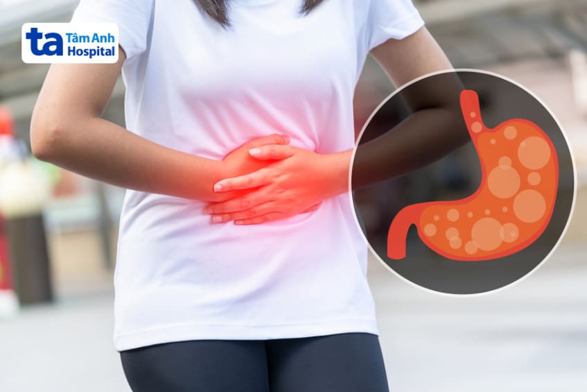 Thuốc Panto Denk 20 điều trị trào ngược nhẹ, ợ chua, ợ nóng