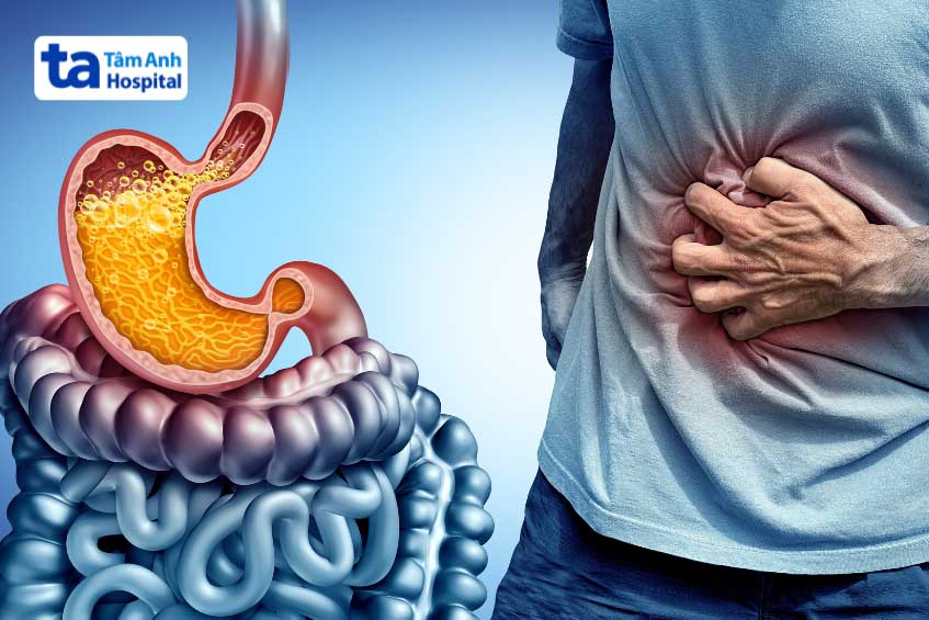 Thuốc Pantoprazol 40mg chống trào ngược dạ dày