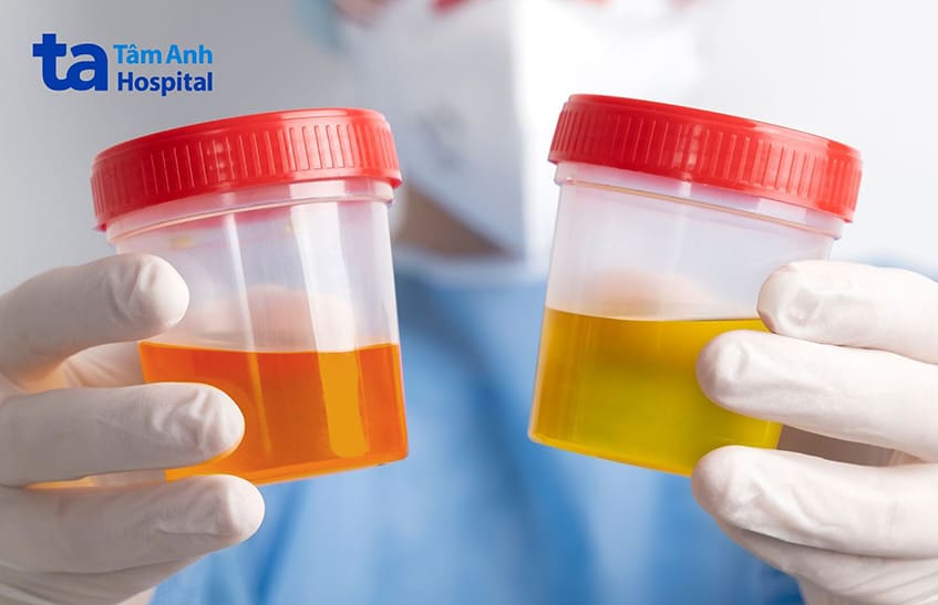 Tiểu ra máu sau quan hệ là hiện tượng không bình thường