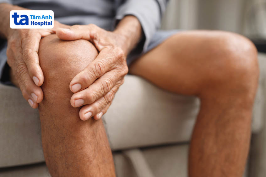 Tình trạng cứng khớp sau bó bột