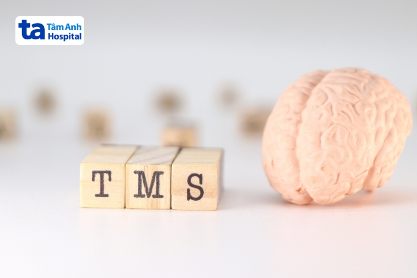tms kích thích não không xâm lấn