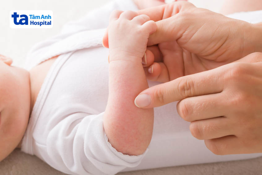 trẻ bị dị ứng khi dùng men vi sinh Enterogermina