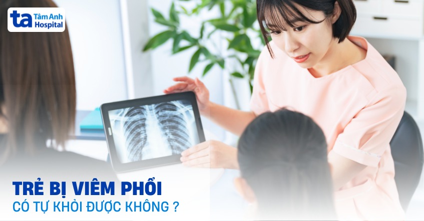 Trẻ bị viêm phổi có tự khỏi được không? Yếu tố nào quyết định?