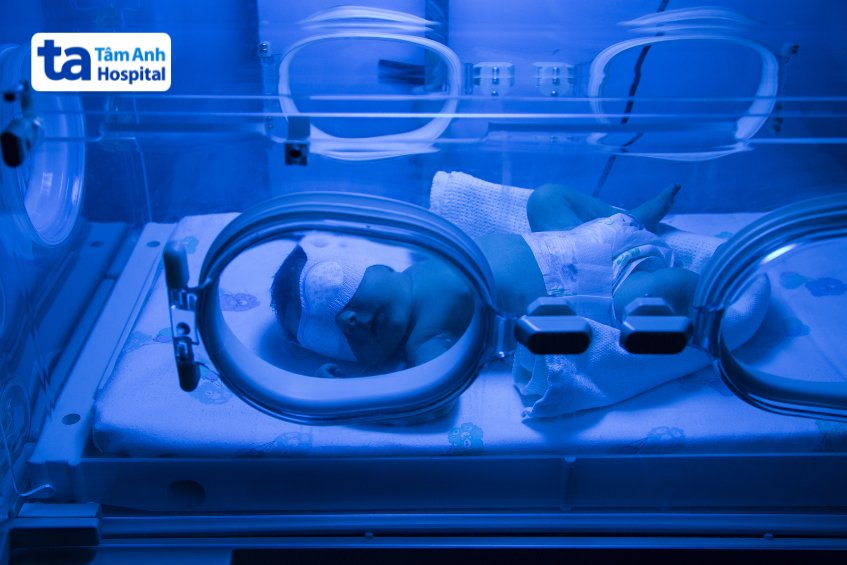 Trẻ vàng da do tăng bilirubin gián tiếp