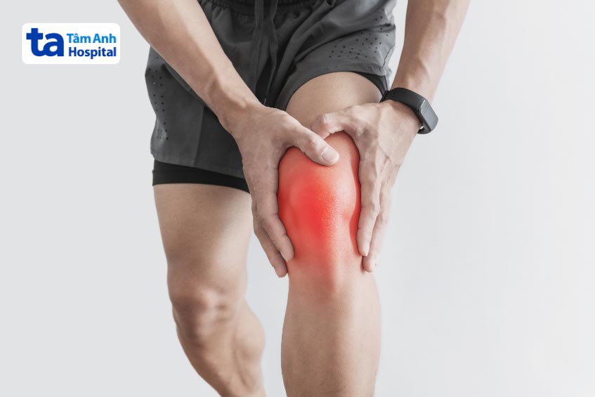 Triệu chứng của sưng đau khớp đầu gối
